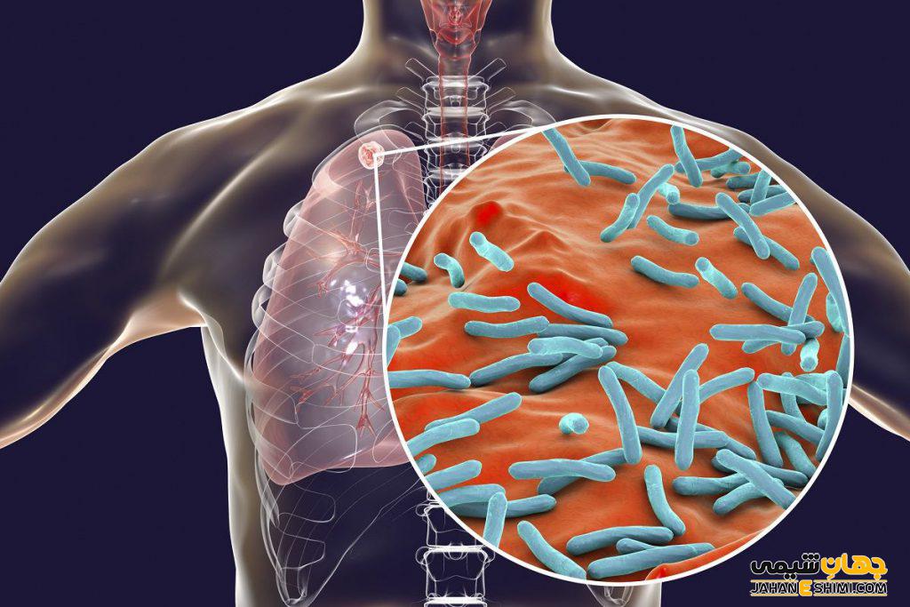 بیماری سل علوم ششم چیست علل علائم تشخیص و درمان جهان شیمی فیزیک