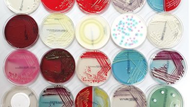 محیط کشت و انواع آن در یگ نگاه کوتاه و اجمالی