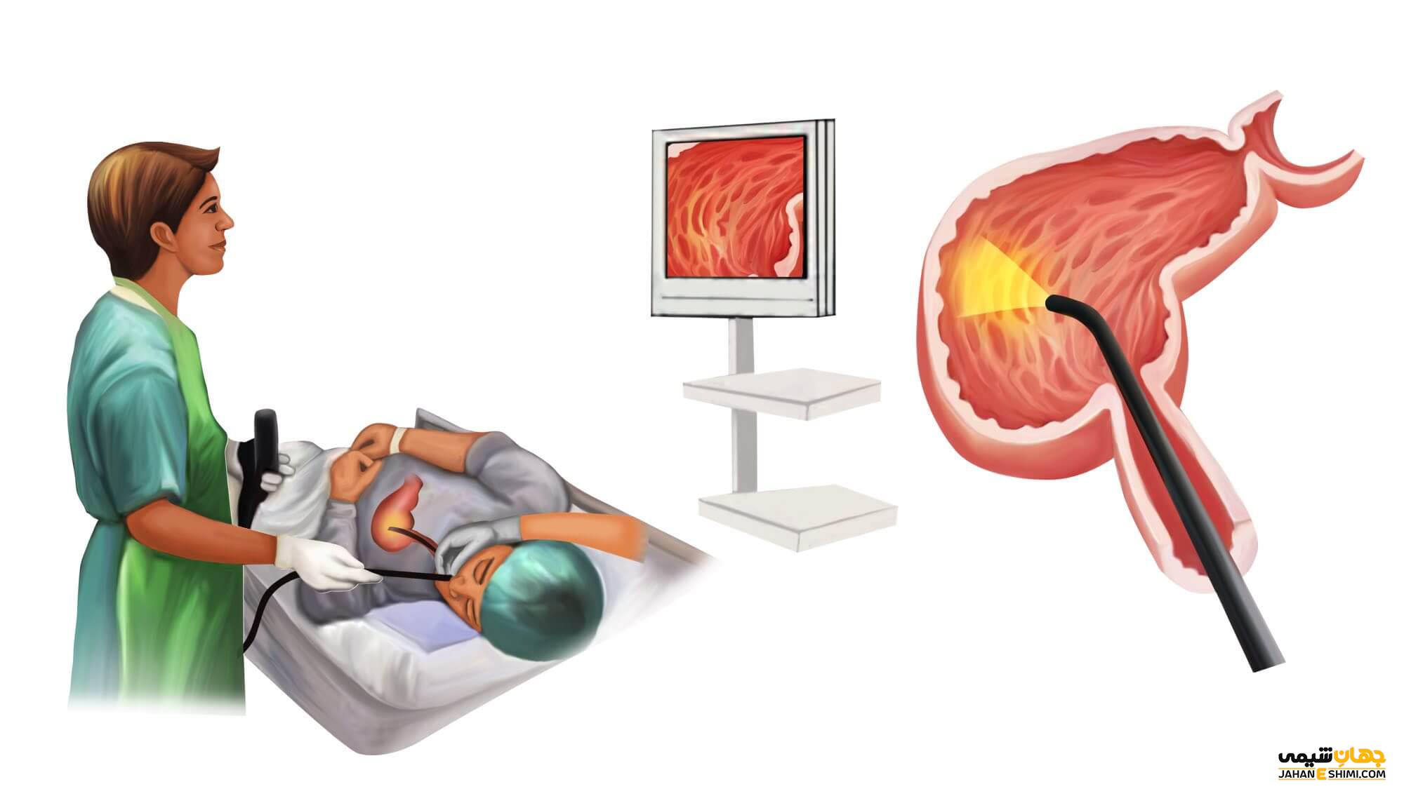 آندوسکوپی چیست و چه کاربردهایی دارد؟ | جهان شیمی فیزیک