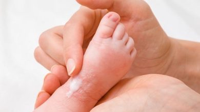 20 مدل از بهترین پماد و کرم سوختگی پای نوزاد