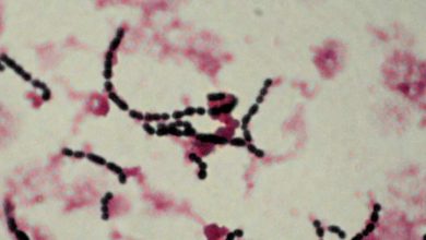 باکتری استرپتوکوکوس ترموفیلوس چیست؟ و کاربرد آن