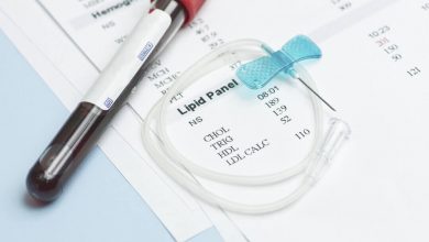 معجزه درمان خانگی چربی خون دارو و علت چربی خون