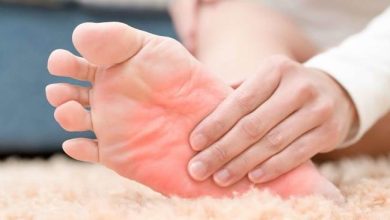 20 علت سوزش کف پا و درمان خانگی آن | دارو برای سوزش کف پا