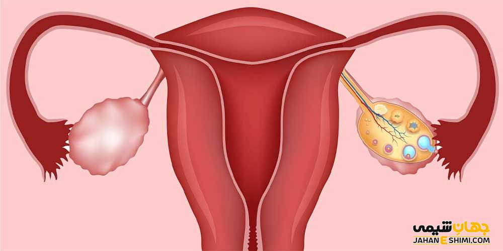 5 علت مهم تنبلی تخمدان چیست؟ | دارو و درمان فوری تنبلی تخمدان