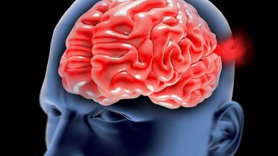 علائم ضربه مغزی چیست؟ | دارو و درمان ضربه مغزی